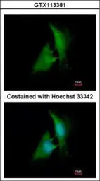 Anti-AKR1B1 antibody [N1C3] used in Immunocytochemistry/ Immunofluorescence (ICC/IF). GTX113381