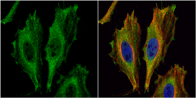 Anti-Aspartoacylase antibody [N1C3-2] used in Immunocytochemistry/ Immunofluorescence (ICC/IF). GTX113389