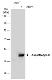 Anti-Aspartoacylase antibody [N1C3-2] used in Western Blot (WB). GTX113389