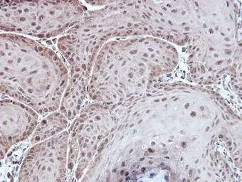 Anti-Aspartoacylase antibody [N1C3-2] used in IHC (Paraffin sections) (IHC-P). GTX113389