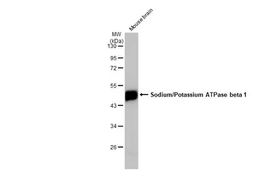 Anti-Sodium/Potassium ATPase beta 1 antibody used in Western Blot (WB). GTX113390