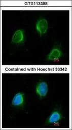 Anti-Calpain 3 antibody [C1C3] used in Immunocytochemistry/ Immunofluorescence (ICC/IF). GTX113398