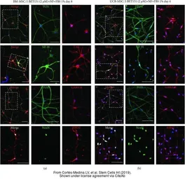 Anti-NSE antibody [C1C3] used in Immunocytochemistry/ Immunofluorescence (ICC/IF). GTX113428