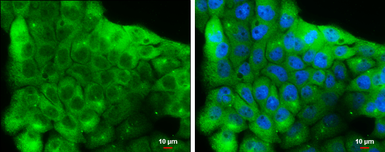 Anti-NSE antibody [C1C3] used in Immunocytochemistry/ Immunofluorescence (ICC/IF). GTX113428