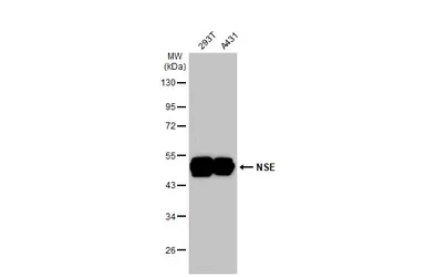 Anti-NSE antibody [C1C3] used in Western Blot (WB). GTX113428
