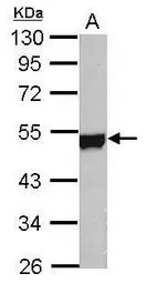 Anti-NSE antibody [C1C3] used in Western Blot (WB). GTX113428