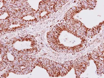 Anti-ERAB antibody [N2C3] used in IHC (Paraffin sections) (IHC-P). GTX113455