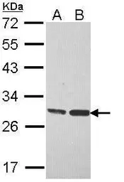 Anti-ERAB antibody [N2C3] used in Western Blot (WB). GTX113455