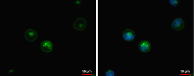 Anti-HLA-DQB1 antibody used in Immunocytochemistry/ Immunofluorescence (ICC/IF). GTX113458