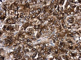 Anti-HLA-DR antibody [N2C3] used in IHC (Paraffin sections) (IHC-P). GTX113459