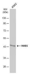 Anti-HMBS antibody [N2C3] used in Western Blot (WB). GTX113460