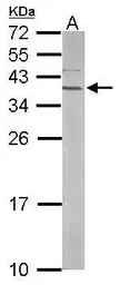 Anti-RPSA antibody [N2C3] used in Western Blot (WB). GTX113485