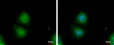 Anti-Galectin 3 antibody used in Immunocytochemistry/ Immunofluorescence (ICC/IF). GTX113486