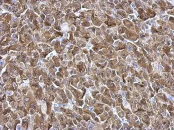 Anti-Galectin 3 antibody used in IHC (Paraffin sections) (IHC-P). GTX113486