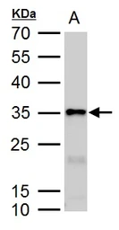 Anti-Galectin 3 antibody used in Western Blot (WB). GTX113486