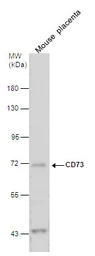 Anti-CD73 antibody [N1N3] used in Western Blot (WB). GTX113509