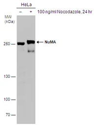 Anti-NuMA antibody [N1], N-term used in Western Blot (WB). GTX113510
