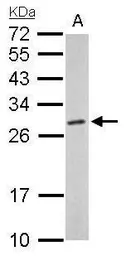 Anti-PSMA6 antibody used in Western Blot (WB). GTX113530