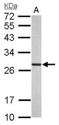 Anti-PSMA6 antibody used in Western Blot (WB). GTX113530