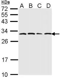 Anti-PSMA6 antibody used in Western Blot (WB). GTX113530