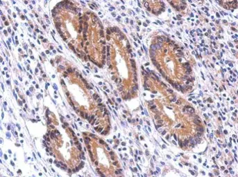 Anti-Nectin 2 antibody [N1N3] used in IHC (Paraffin sections) (IHC-P). GTX113535