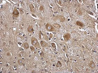 Anti-Seryl-tRNA synthetase antibody [N1C2] used in IHC (Paraffin sections) (IHC-P). GTX113546