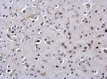 Anti-SSB antibody used in IHC (Paraffin sections) (IHC-P). GTX113555
