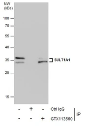 Anti-SULT1A1 antibody used in Immunoprecipitation (IP). GTX113560
