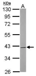 Anti-SAE1 antibody used in Western Blot (WB). GTX113602