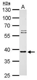 Anti-SAE1 antibody used in Western Blot (WB). GTX113602