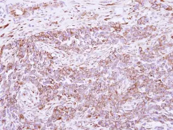 Anti-DLC1 antibody [C2C3], C-term used in IHC (Paraffin sections) (IHC-P). GTX113607