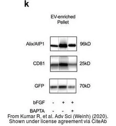 Anti-GFP antibody used in Western Blot (WB). GTX113617