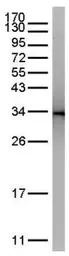 Anti-GFP antibody used in Immunoprecipitation (IP). GTX113617