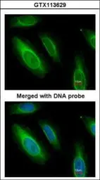 Anti-ASL antibody used in Immunocytochemistry/ Immunofluorescence (ICC/IF). GTX113629