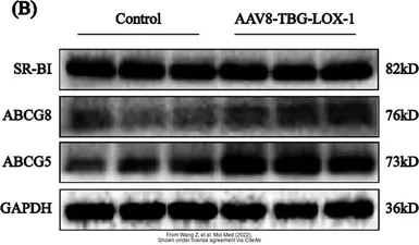 Anti-SR-BI antibody used in Western Blot (WB). GTX113645