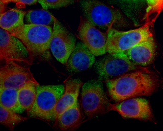 Anti-SR-BI antibody used in Immunocytochemistry/ Immunofluorescence (ICC/IF). GTX113645