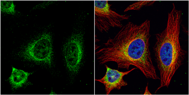 Anti-SR-BI antibody used in Immunocytochemistry/ Immunofluorescence (ICC/IF). GTX113645