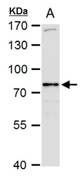 Anti-SR-BI antibody used in Western Blot (WB). GTX113645