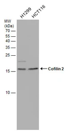 Anti-Cofilin 2 antibody used in Western Blot (WB). GTX113650