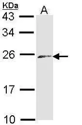 Anti-Endothelin 3 antibody [N1C3] used in Western Blot (WB). GTX113678