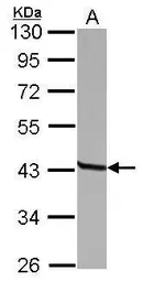 Anti-CD23 antibody [N3C3] used in Western Blot (WB). GTX113692