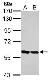 Anti-ERp57 antibody used in Western Blot (WB). GTX113719