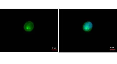 Anti-HLA-DRA antibody [N2C3] used in Immunocytochemistry/ Immunofluorescence (ICC/IF). GTX113732