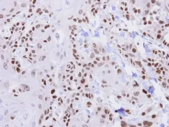 Anti-HUS1 antibody used in IHC (Paraffin sections) (IHC-P). GTX113745
