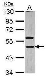 Anti-KIR3DL1 antibody [N1C2] used in Western Blot (WB). GTX113763