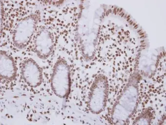 Anti-MSH3 antibody [C2C3], C-term used in IHC (Paraffin sections) (IHC-P). GTX113781