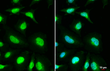 Anti-MSH3 antibody [C2C3], C-term used in Immunocytochemistry/ Immunofluorescence (ICC/IF). GTX113781