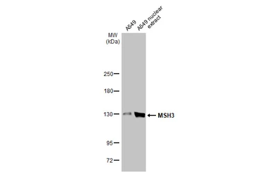 Anti-MSH3 antibody [C2C3], C-term used in Western Blot (WB). GTX113781