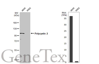 Anti-Polycystin 2 antibody used in Western Blot (WB). GTX113802