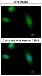 Anti-RAD23B antibody used in Immunocytochemistry/ Immunofluorescence (ICC/IF). GTX113820
